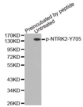 NTRK2 / TRKB Antibody (phospho-Tyr705)