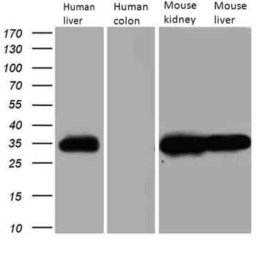 CBR / CBR1 Antibody (clone OTI4B4)