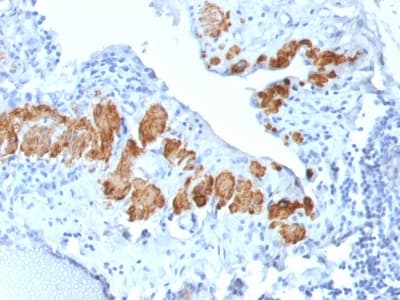 PathPlus™ SMMHC / MYH11 Antibody (clone MYH11/2303R)
