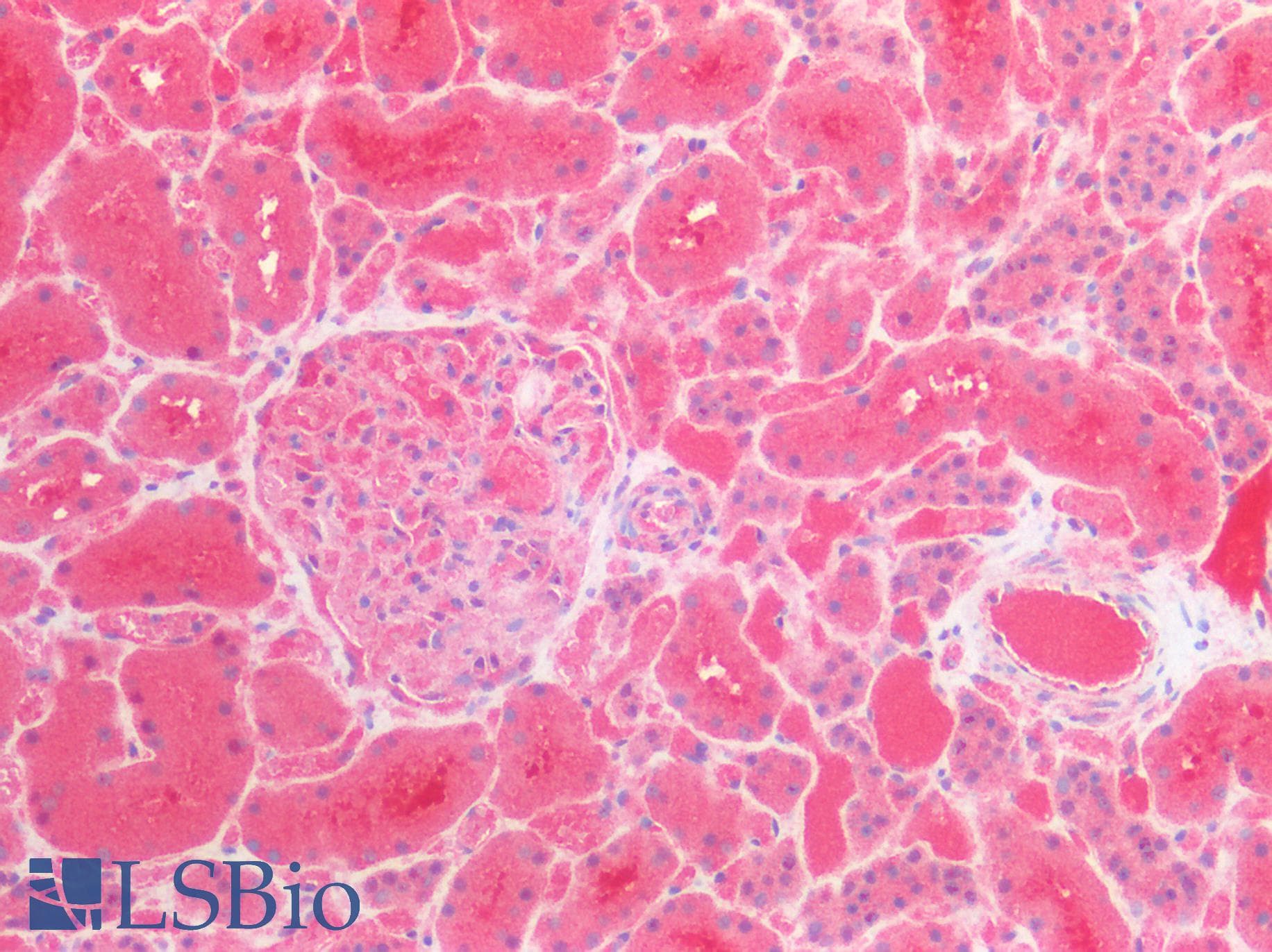 IHC-plus™ QPRT Antibody (clone AT24C4)