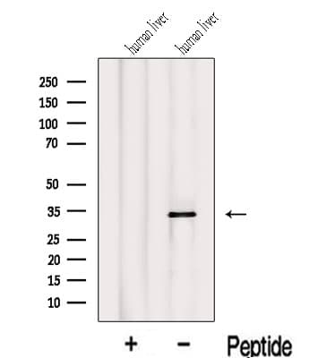 IYD Antibody