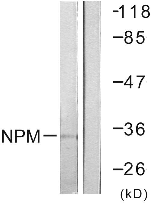 NPM1 / NPM / Nucleophosmin Antibody (p199)