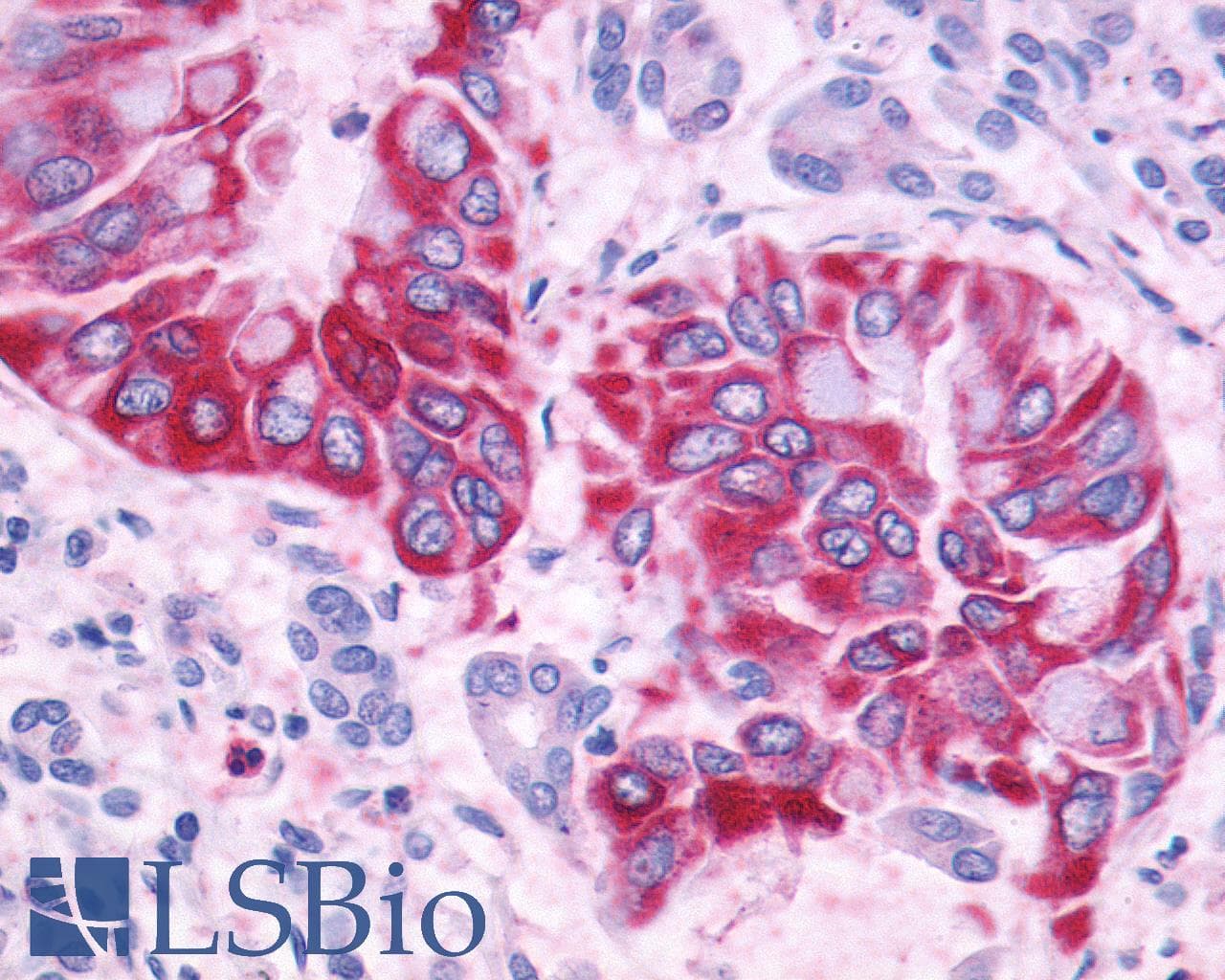 PathPlus™ Polyclonal Rabbit anti-Human ADGRF1 / GPR110 Antibody (N-Terminus, IHC)