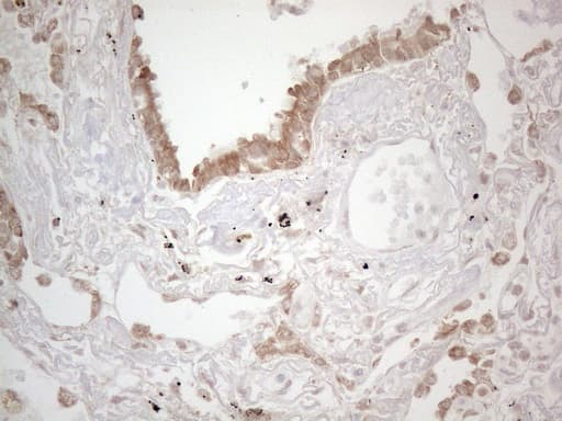 PODXL / Podocalyxin Antibody (aa32-461, clone OTI2C6)
