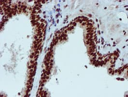 Monoclonal Mouse anti-Human PADI4 / PAD4 Antibody (clone OTI4H5, IHC, IF, WB)
