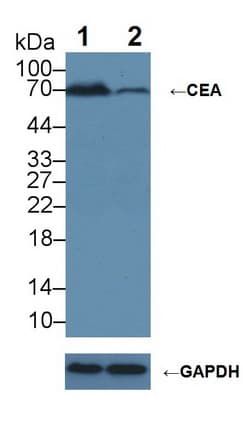 CEA / Carcinoembryonic Antigen Antibody (aa448-572)