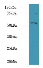 ZNF238 Antibody