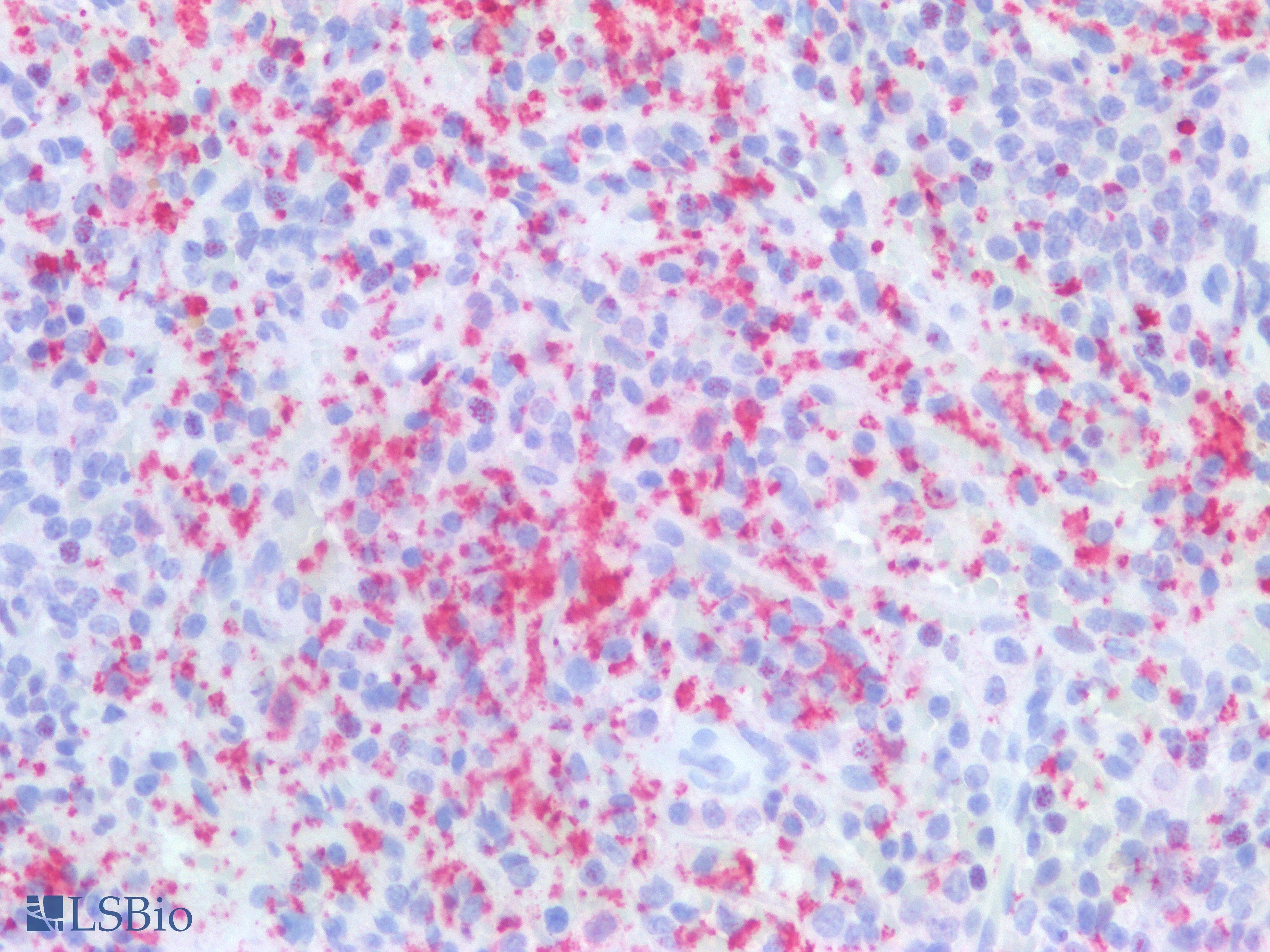 PathPlus™ Monoclonal Mouse anti-Human F13A1 / Factor XIIIa Antibody (IHC)