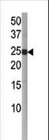 BID Antibody (phospho-Ser65)