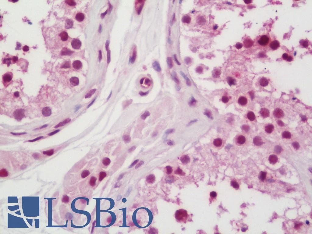 IHC-plus™ Polyclonal Rabbit anti-Human LIN28A / LIN28 Antibody (aa108-138, IHC, IF, WB)