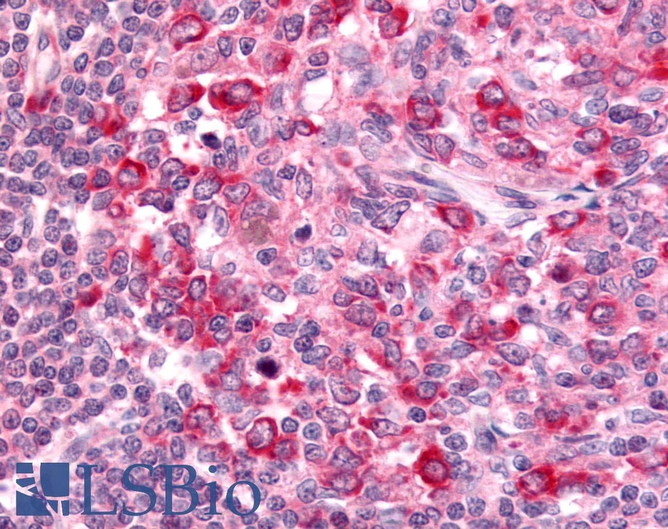IHC-plus™ GPR65 / TDAG8 Antibody (Extracellular Domain)
