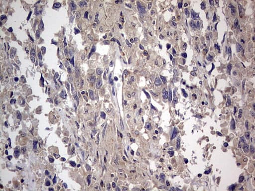 Monoclonal Mouse anti-Human SMPD1 / Acid Sphingomyelinase Antibody (clone OTI3H7, aa62-341, IHC, WB)