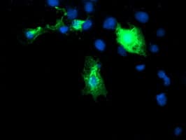 DIXDC1 Antibody (clone OTI1B3)