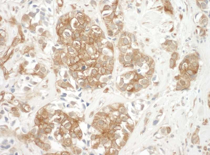 IHC-plus™ CTTN / Cortactin Antibody (aa450-500)