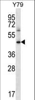 CD119 / IFNGR1 Antibody (aa463-489)