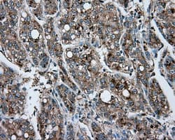 ACSBG1 / hsBG Antibody (clone OTI2B5)
