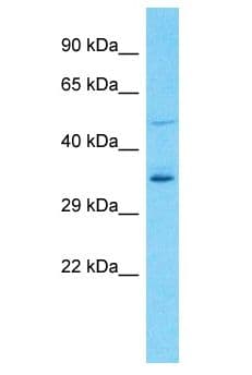 OR8U9 Antibody (aa257-306)