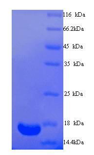 Human TRIM24 / TIF1 Protein (Recombinant His)