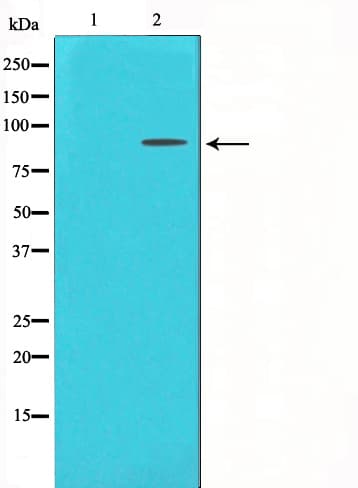 Polyclonal Rabbit anti-Human FGFR3 Antibody (IHC, IF, WB)