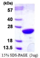 Human UBE2M / UBC12 Protein (Recombinant His)