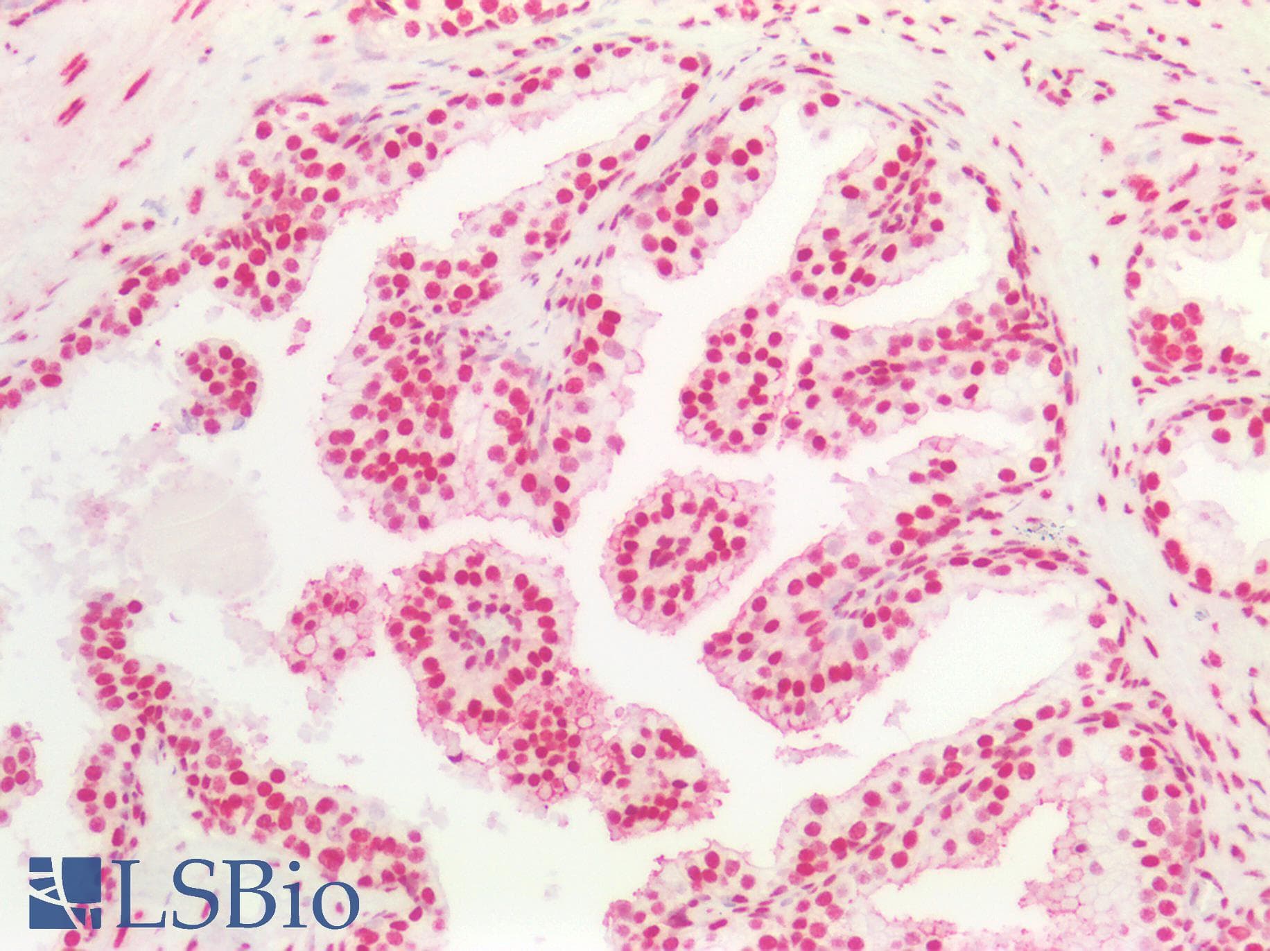 PathPlus™ HNRNPK / hnRNP K Antibody (aa200-250)