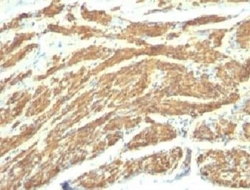 CALD1 / Caldesmon Antibody (clone SPM168)