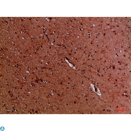 EYA1 Antibody