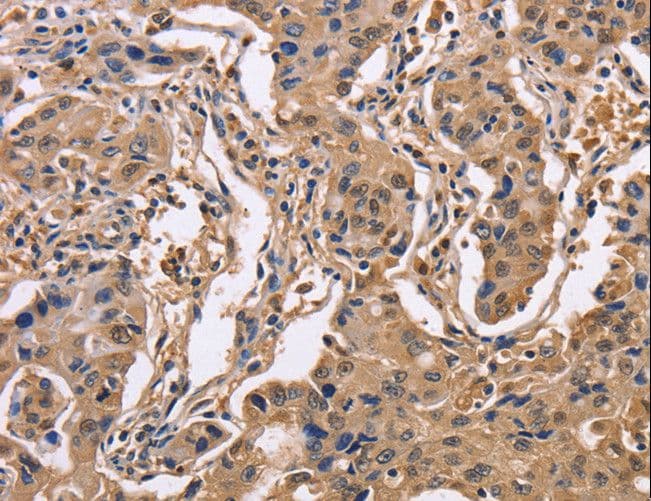 Polyclonal Rabbit anti-Human IDH1 / IDH Antibody (IHC, WB)