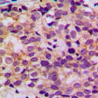 BCL2 / Bcl-2 Antibody (phospho-Ser87)