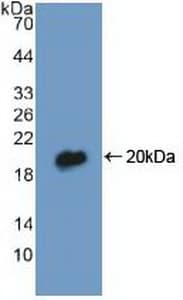 DBI / ACBD1 Antibody (aa1-87, HRP)