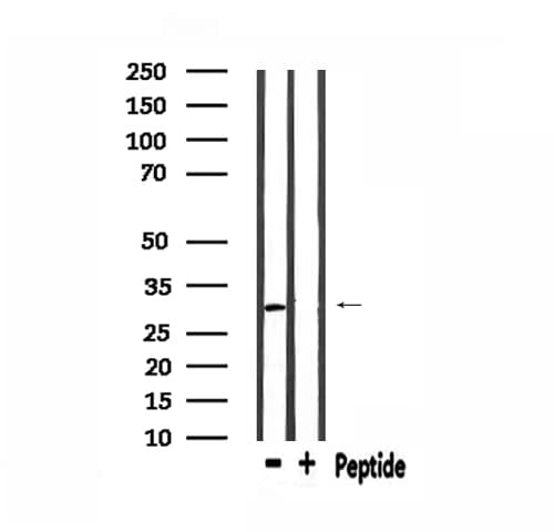 Polyclonal Rabbit anti-Human GAX / MEOX2 Antibody (IF, WB)