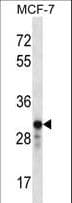 GRAP2 / GRID Antibody (aa131-159)