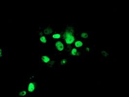 ATRIP Antibody (clone OTI5E7)