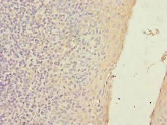 Polyclonal Rabbit anti-Human SLC23A2 / SVCT2 Antibody (IHC, WB)
