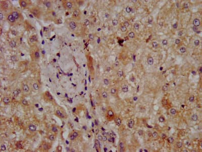 Polyclonal Rabbit anti-Human CPOX Antibody (IF, WB)