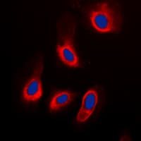 Polyclonal Rabbit anti-Human ADPGK Antibody (Internal, IHC, IF, WB)