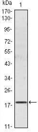 IHC-plus™ Monoclonal Mouse anti-Human IL6 / Interleukin 6 Antibody (clone 6D9A1, IHC, WB)