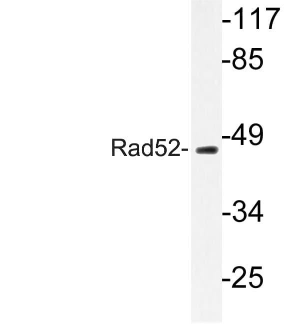 RAD52 Antibody (Asn99)