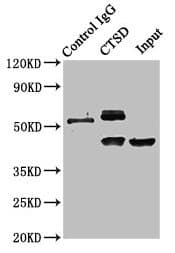 IHC-plus™ CTSD / Cathepsin D Antibody (aa 67-403)
