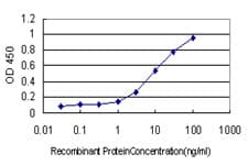 CLU / Clusterin Antibody (clone 1A11)