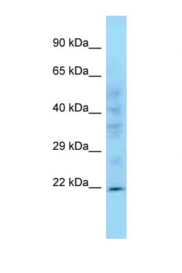 Polyclonal Rabbit anti-Mouse PPIC / Cyclophilin C Antibody (C-Terminus, WB)
