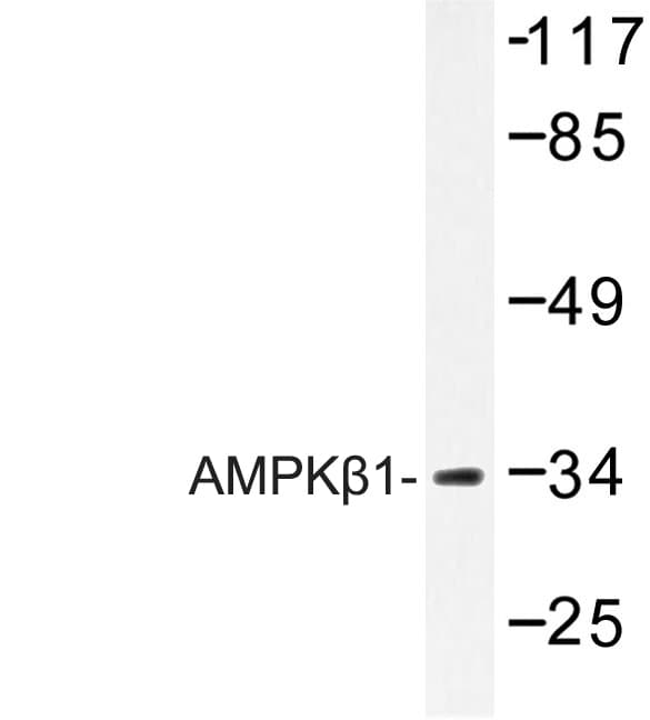 PRKAB1 / AMPK Beta 1 Antibody (His17)