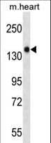 Polyclonal Rabbit anti-Mouse GUCY2F Antibody (aa317-344, WB)