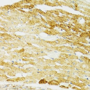 Polyclonal Rabbit anti-Human HSPA9 / Mortalin / GRP75 Antibody (IHC, IF, WB)