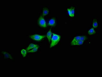 Polyclonal Rabbit anti-Human ATG2B Antibody (IHC)