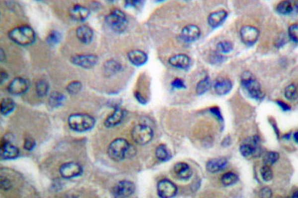 Polyclonal Rabbit anti-Human COL4A1 / Collagen IV Alpha1 Antibody (Gly46, IHC, WB)