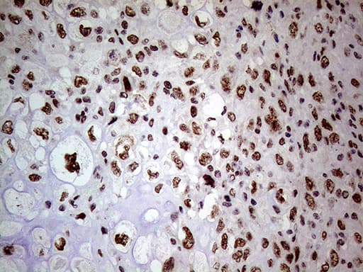 NSD3 / WHSC1L1 Antibody (aa427-566, clone OTI3B3, Carrier-free)