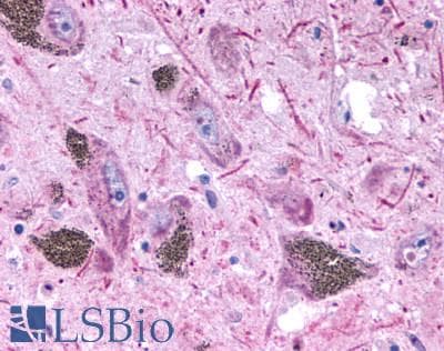 PathPlus™ HTR2B / 5-HT2B Receptor Antibody (N-Terminus)