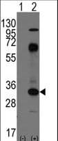 CD8A / CD8 Alpha Antibody (aa150-180)