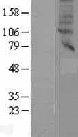SLC47A2 Protein (Over-Expression Lysate Myc-DDK (Flag))